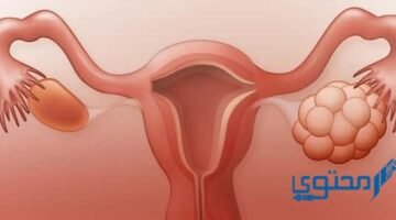 على المبيض بالصور