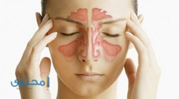 الجيوب الأنفية