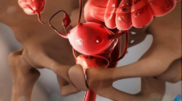 الرحم المهاجرة1