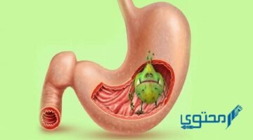 جرثومة المعدة